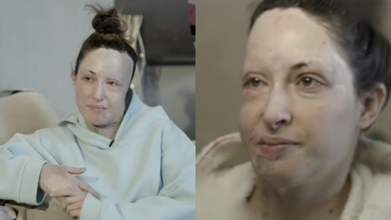 Συγκλονίζει η Ιωάννα Παλιοσπύρου - Η πρώτη της φορά χωρίς μάσκα στο φακό! (vid)